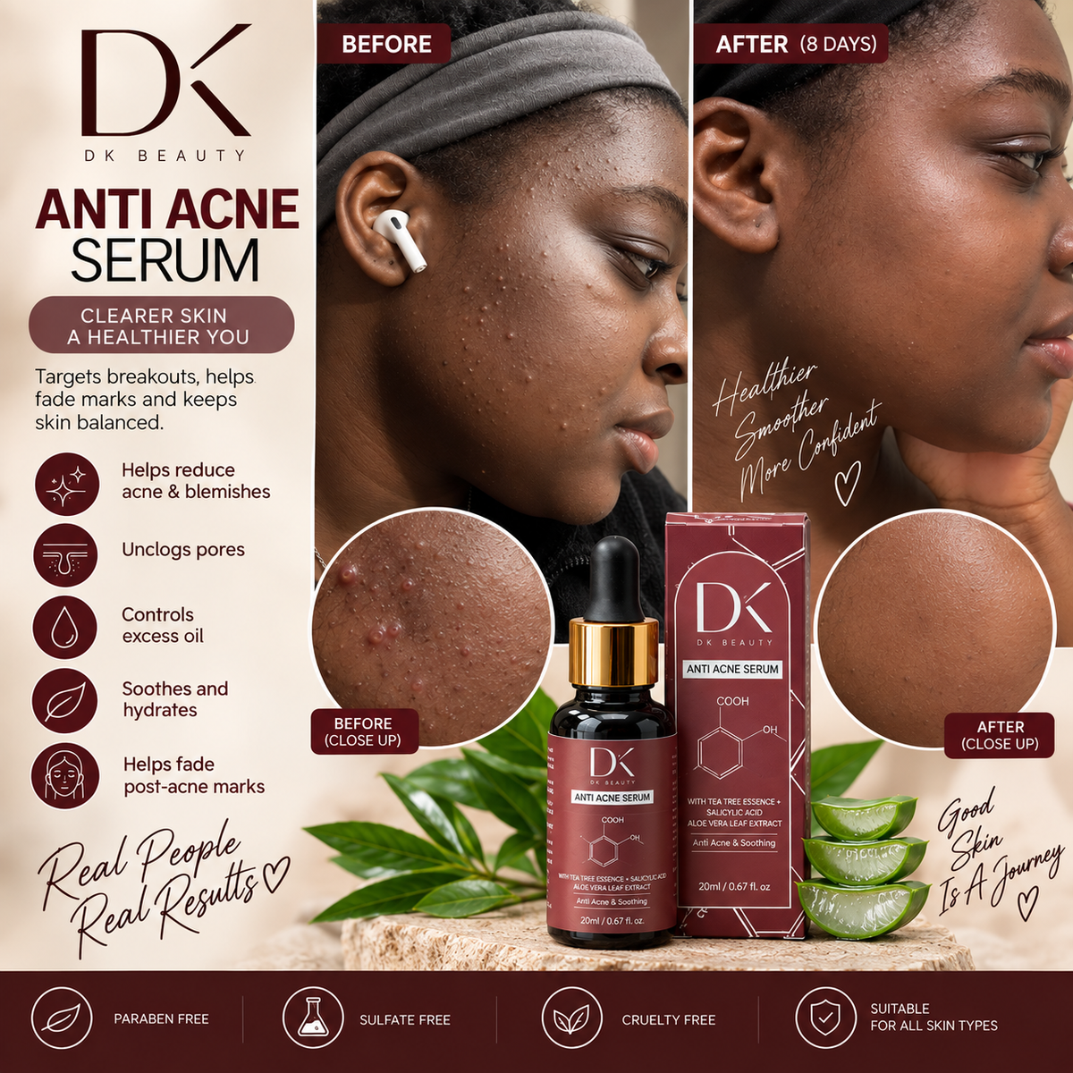 ANTI-ACNE SERUM